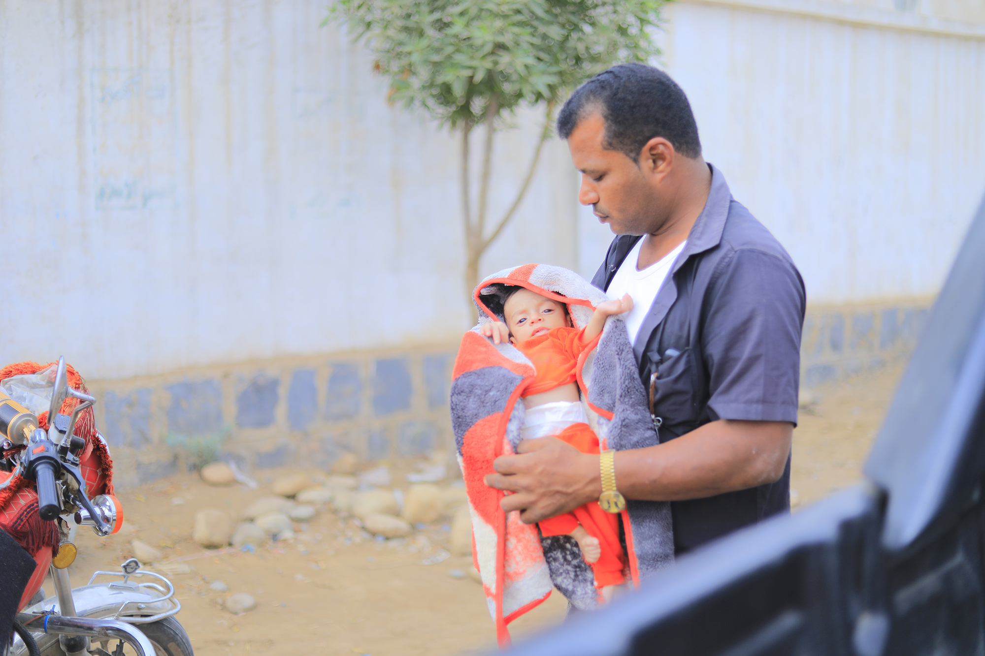 A Father’s Hope: Saddam’s Journey to Save His Son from Malnutrition in Yemen